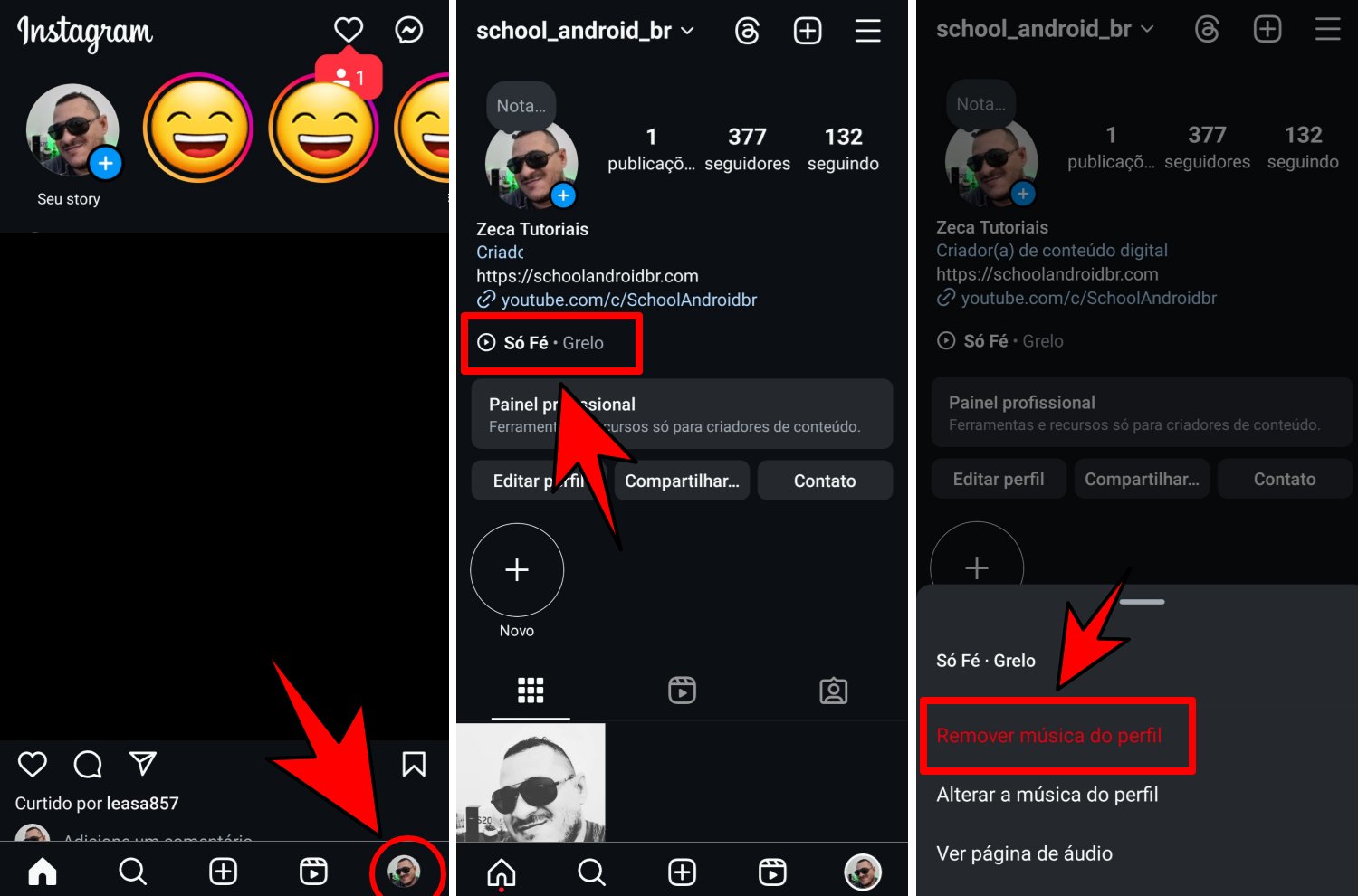 como remover música no perfil do Instagram